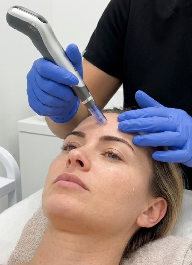 Hair Restoration